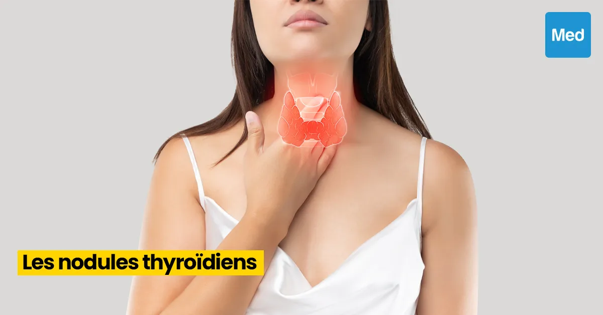 Comprendre les Nodules Thyroïdiens : Symptômes, Causes et Conseils de Gestion